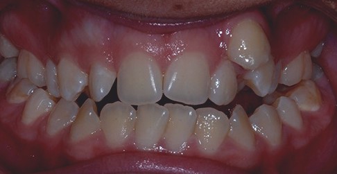 case1-2
