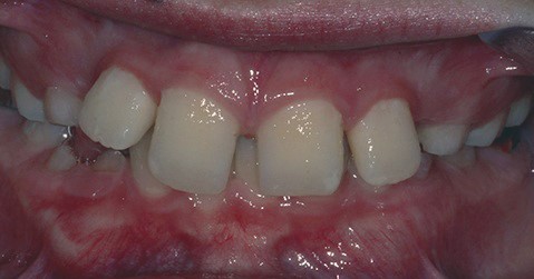 case2-2