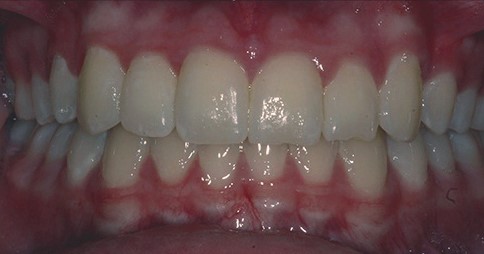 case2