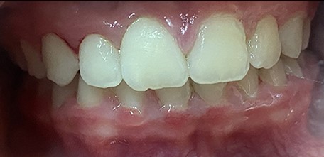 case4-2